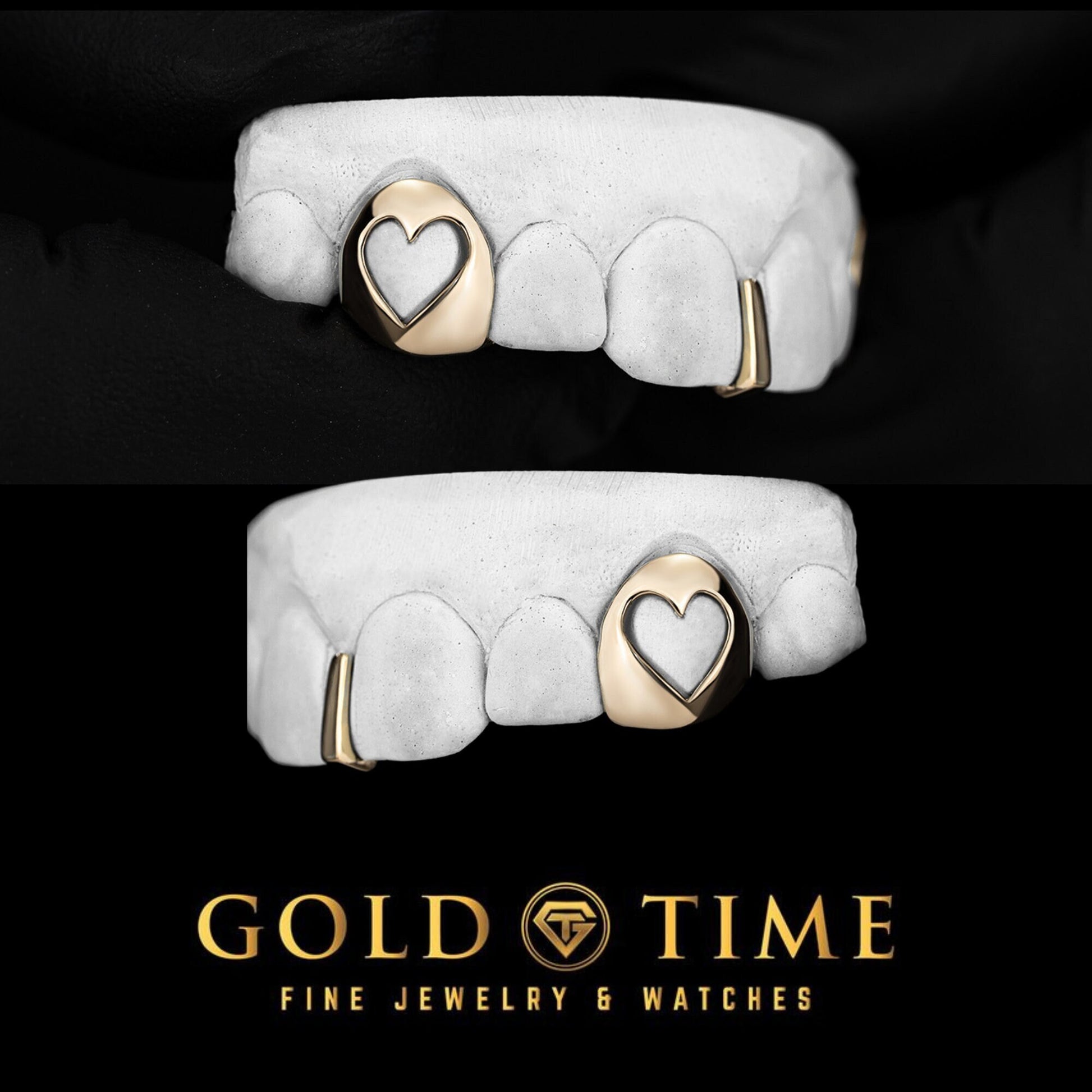 Custom Gold Grillz – Heart Cut Out Canines & Gap Bar - 10K, 14K, or Silver - Handmade Luxury Dental Grills - Yellow, White, or Rose Gold