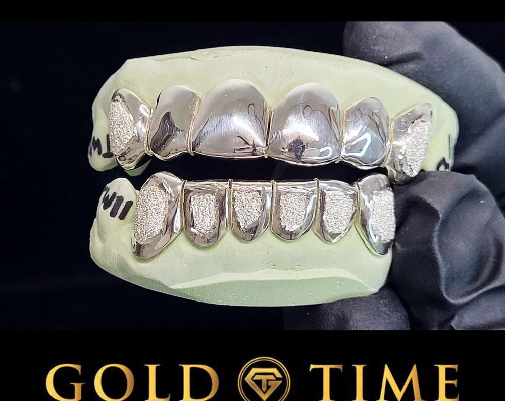 Custom 12-Piece Diamond Dust Grillz with Perm Cuts